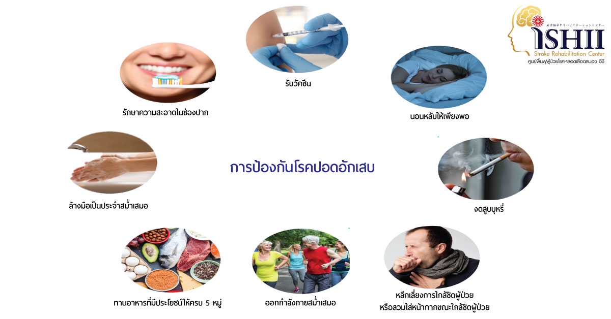 การป้องกันโรคปอดอัคเสบ