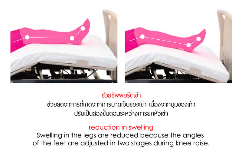 Reduction in swelling